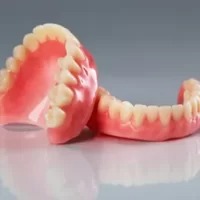 Conventional Denture - Acrylic plastic removable denture