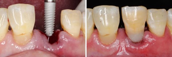 Cosmetic Dentistry 2