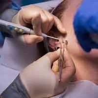 Minor Skin Surgical Procedure
