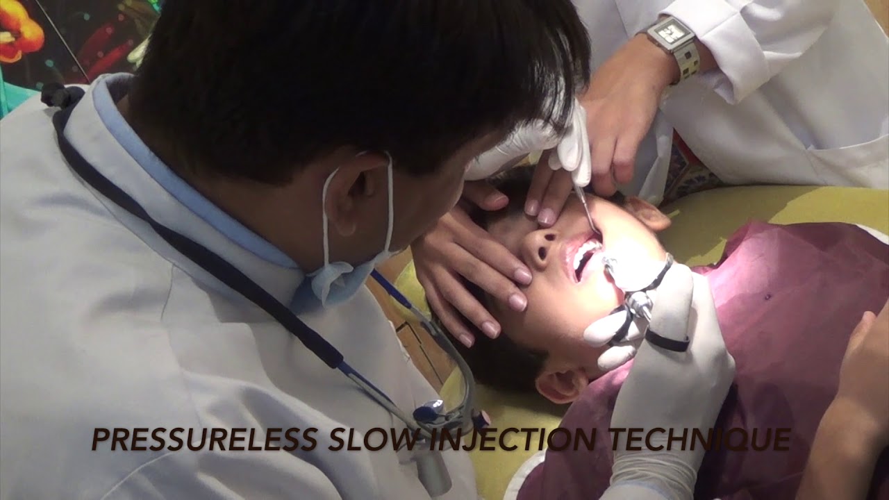 NEW Painless Injection Dental Treatment For Perfect Kids Teeth