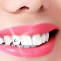 Dental Jewelry